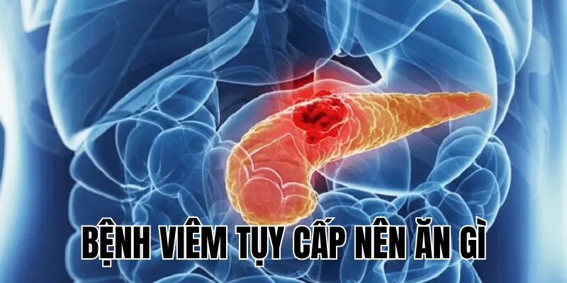 bệnh viêm tụy cấp nên ăn gì