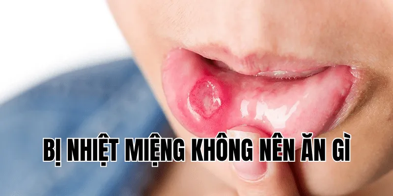bị nhiệt miệng không nên ăn gì