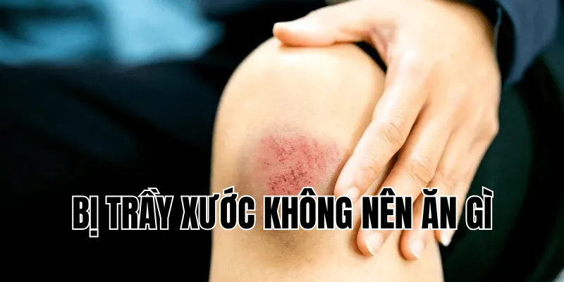 bị trầy xước không nên ăn gì
