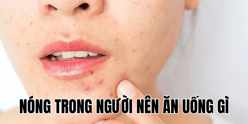 nóng trong người nên ăn uống gì